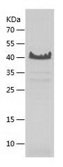    NACA1 / Recombinant Human NACA1