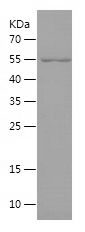    MORC3 / Recombinant Human MORC3