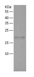    ARHGEF7 / Recombinant Human ARHGEF7