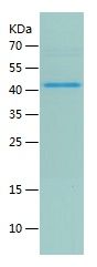    RCN2 / Recombinant Human RCN2