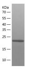    GAMT / Recombinant Human GAMT