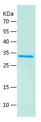    LASP1 / Recombinant Human LASP1