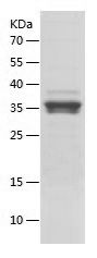    MYBPC3 / Recombinant Human MYBPC3