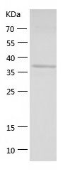    Septin 2 / Recombinant Human Septin 2