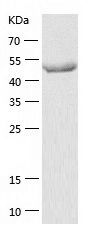    TNIP1 / Recombinant Human TNIP1