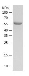    LysRS / Recombinant Human LysRS