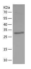    p40-phox / Recombinant Human p40-phox