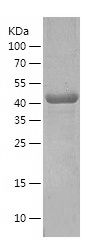    PDIA6 / Recombinant Human PDIA6