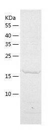    Phosphomevalonate kinase / Recombinant Human Phosphomevalonate kinase