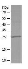    Pyrophosphatase 1 / Recombinant Human Pyrophosphatase 1