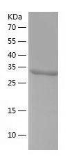    QPRT / Recombinant Human QPRT