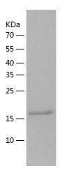    RAB35 / Recombinant Human RAB35