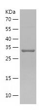    RCN1 / Recombinant Human RCN1