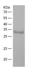    ANKRD1 / Recombinant Human ANKRD1