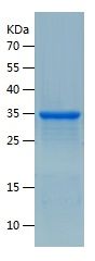    SMP30 / Recombinant Human SMP30