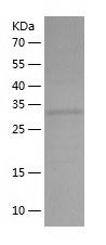    EB2 / Recombinant Human EB2