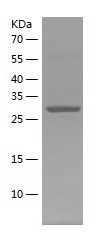    TOMM34 / Recombinant Human TOMM34