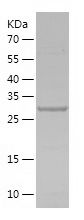    IGFBP7 / Recombinant Human IGFBP7