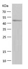    CAMKIV / Recombinant Human CAMKIV