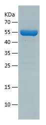    Fascin / Recombinant Human Fascin