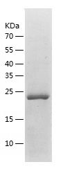    CDKN3 / Recombinant Human CDKN3