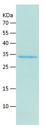    DECR1 / Recombinant Human DECR1