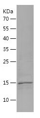    Histone H2B / Recombinant Human Histone H2B