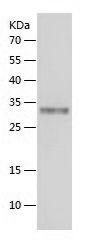    ICA 512 / Recombinant Human ICA 512