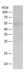    UGPase / Recombinant Human UGPase