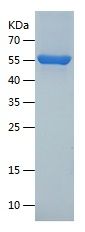    TXNRD1 / Recombinant Human TXNRD1