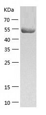    TXNRD1 / Recombinant Human TXNRD1