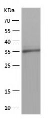    MTHFSD / Recombinant Human MTHFSD