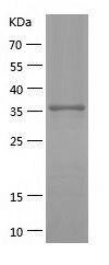    ZIK1 / Recombinant Human ZIK1