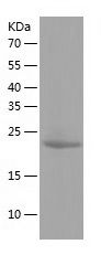    ANKDD1A / Recombinant Human ANKDD1A