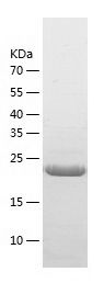    TIGD5 / Recombinant Human TIGD5