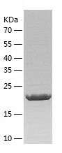    ACSM3 / Recombinant Human ACSM3