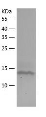    TSSC3 / Recombinant Human TSSC3