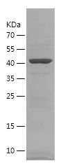    IGSF11 / Recombinant Human IGSF11