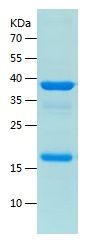    KHDC1L / Recombinant Human KHDC1L