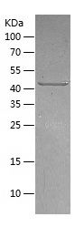    TBCEL / Recombinant Human TBCEL