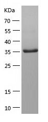    HePTP / Recombinant Human HePTP