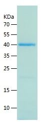    YOD1 / Recombinant Human YOD1