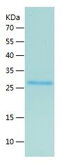    LYPLAL1 / Recombinant Human LYPLAL1