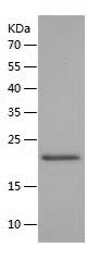 Recombinant Mouse Dhh