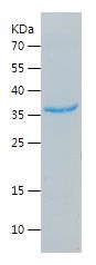    FLJ39155 / Recombinant Human FLJ39155