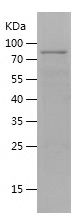    ERVK-6 / Recombinant Human ERVK-6