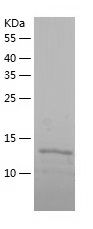    PTRHD1 / Recombinant Human PTRHD1