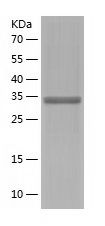    GLYAT / Recombinant Human GLYAT