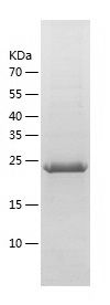    HLA-DMA / Recombinant Human HLA-DMA