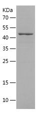    ACSM5 / Recombinant Human ACSM5